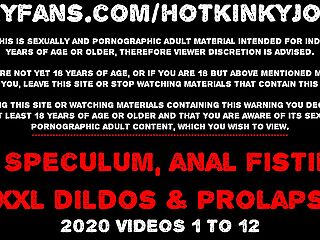Hotkinkyjo XO speculum prolapse deep dildo belly bulge anal fisting & extraordinary injections - onlyfans
